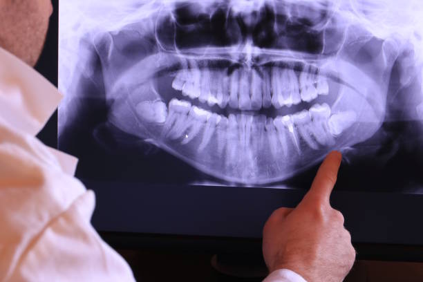 Best Urgent Tooth Repair  in Berlin, OH