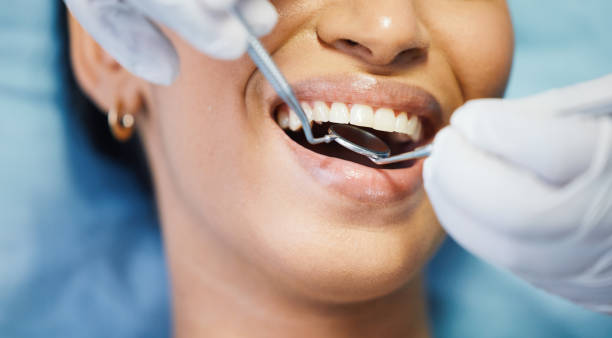 Best Dentist for Tooth Abscess  in Berlin, OH