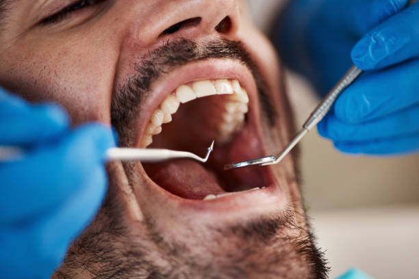 Best Broken Tooth Emergency  in Berlin, OH