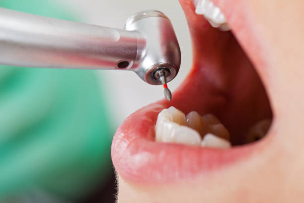 Best Dentist for Tooth Abscess  in Berlin, OH